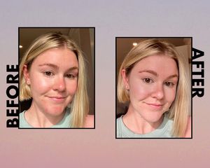 Byrdie writer Melony Forcier's skin before and after applying Huda Beauty's FauxFilter Concealer